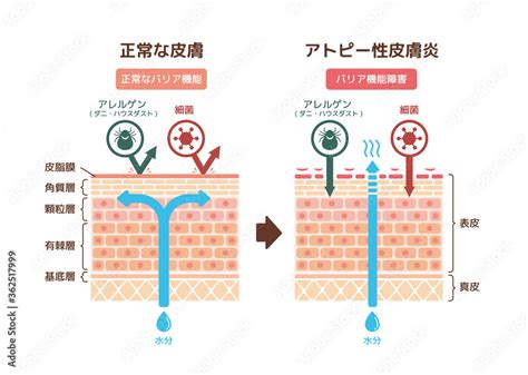 健康的皮膚|Q1 健康な皮膚とはどんな皮膚？ : Part1 健康な皮膚と。